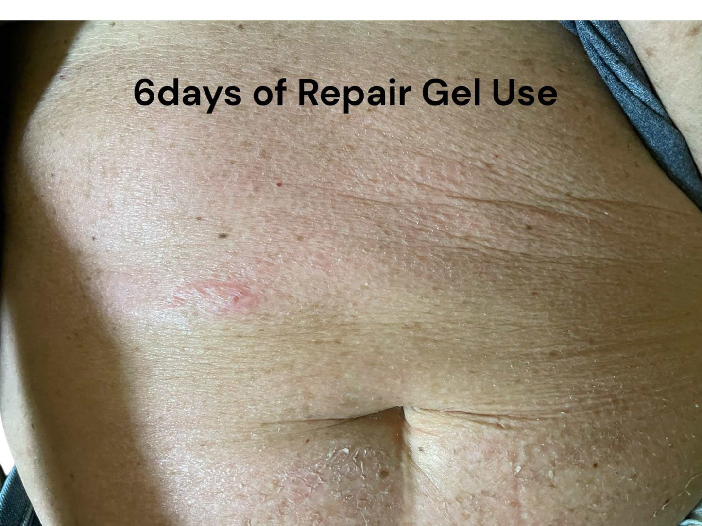 Repair Gel